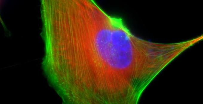 Actin and tubulin staining of a cell